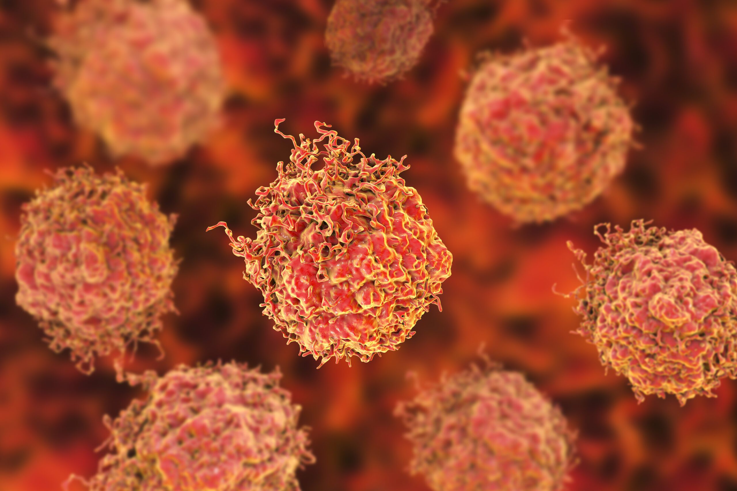 Prostate cancer cells 3d illustration