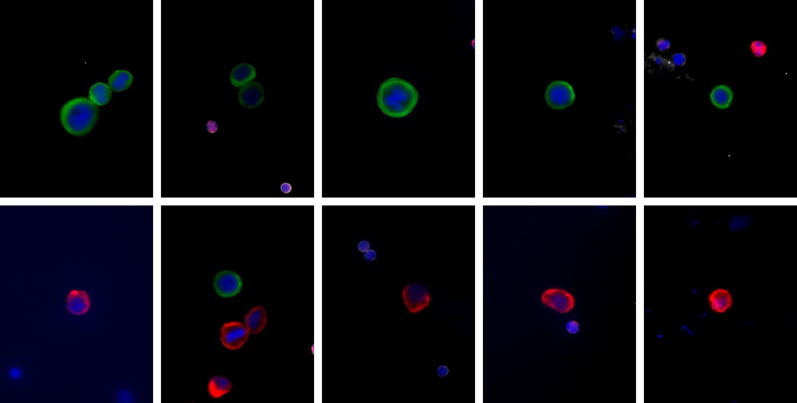 Examples of Portrait+ CTC staining kit samples