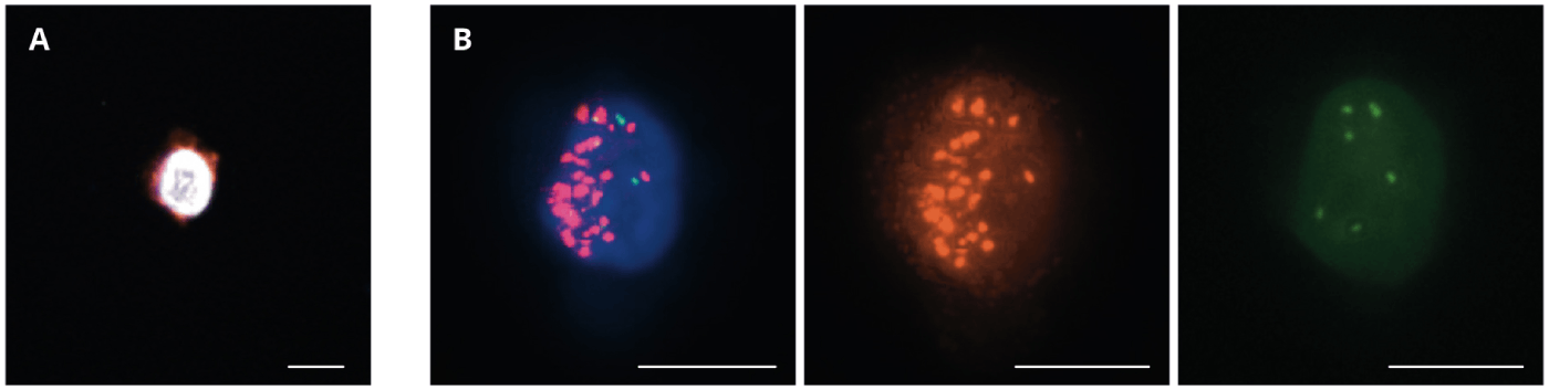 HER2 Cell image