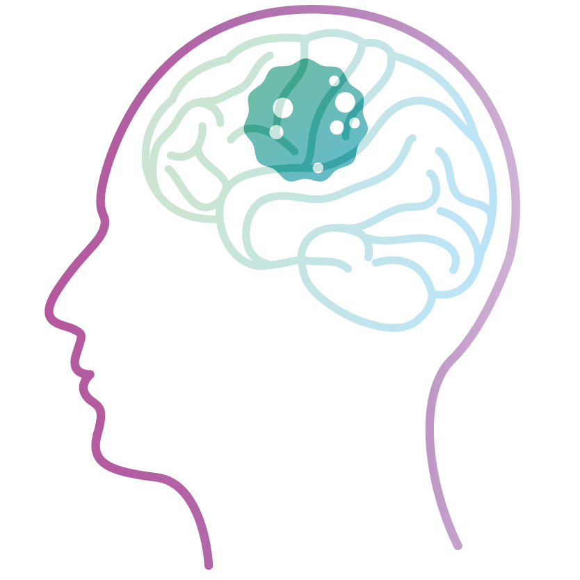 glioblastoma drug development summit logo